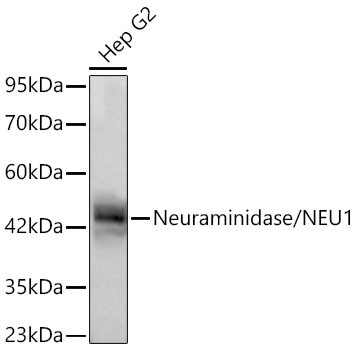 Neuraminidase/NEU1 Rabbit mAb