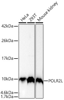 [KD Validated] POLR2L Rabbit mAb