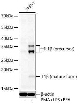 IL1β Rabbit mAb