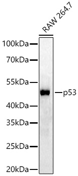 p53 Rabbit mAb