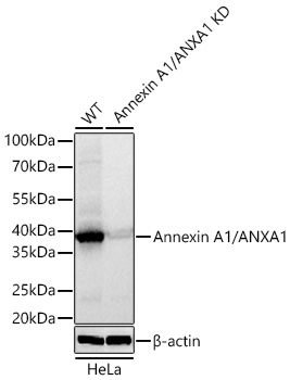 [KD Validated] Annexin A1/ANXA1 Rabbit mAb