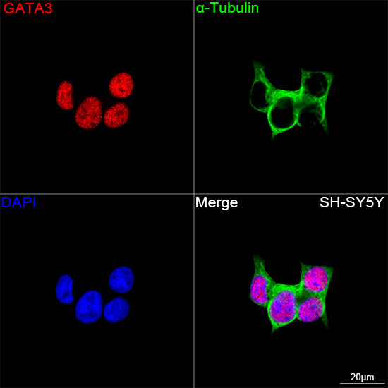 GATA3 Rabbit mAb