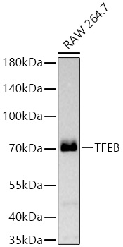 [KD Validated] TFEB Rabbit mAb