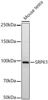 SRPK1 Rabbit mAb