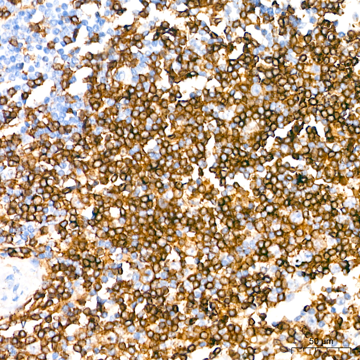 CD4 Rabbit PolymAb®
