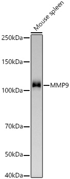 MMP9 Rabbit mAb