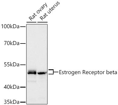 Estrogen Receptor beta Rabbit mAb