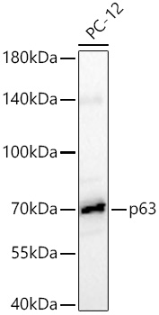 p63 Rabbit mAb