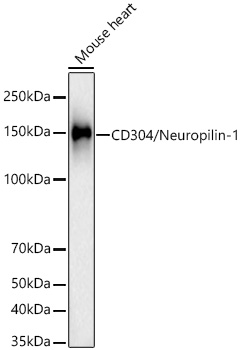 CD304/Neuropilin-1 Rabbit mAb