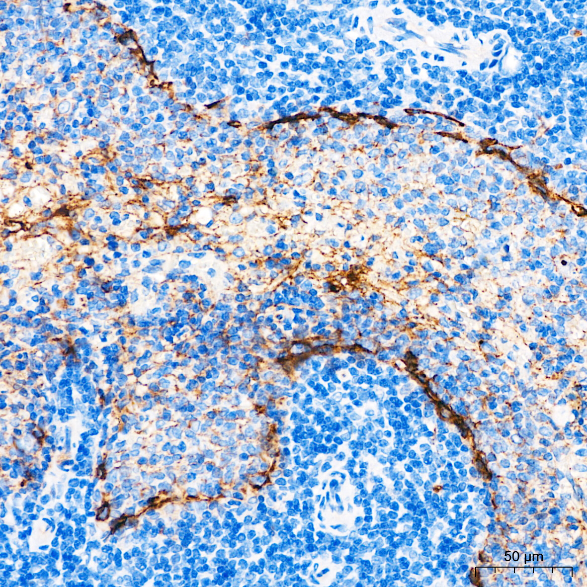 CD36/SR-B3 Rabbit mAb