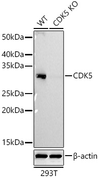 CDK5 Rabbit mAb