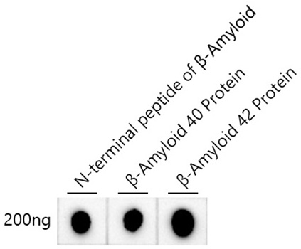 β-Amyloid Rabbit mAb