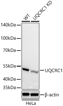 [KD Validated] UQCRC1 Rabbit mAb