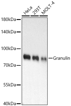 Granulin Rabbit PolymAb®