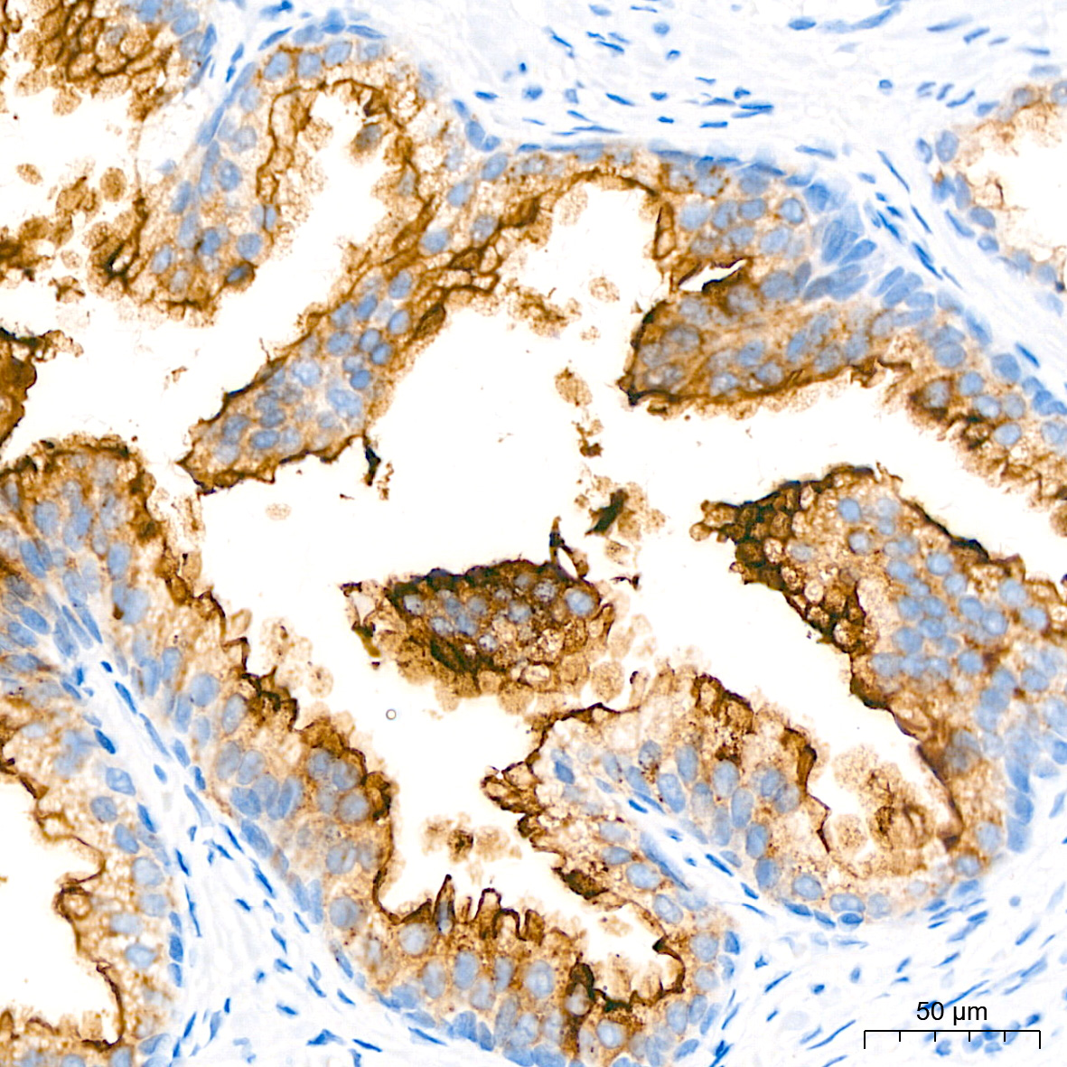 MaAページ Amazon.com: Exmark 109-9828 Hydraulic Oil 1 Quart Bottle