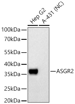 ASGR2 Rabbit mAb