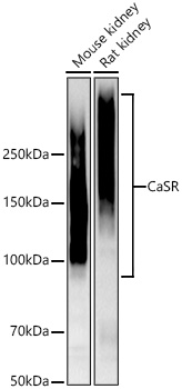 CaSR Rabbit mAb