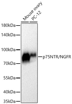 p75NTR/NGFR Rabbit PolymAb®