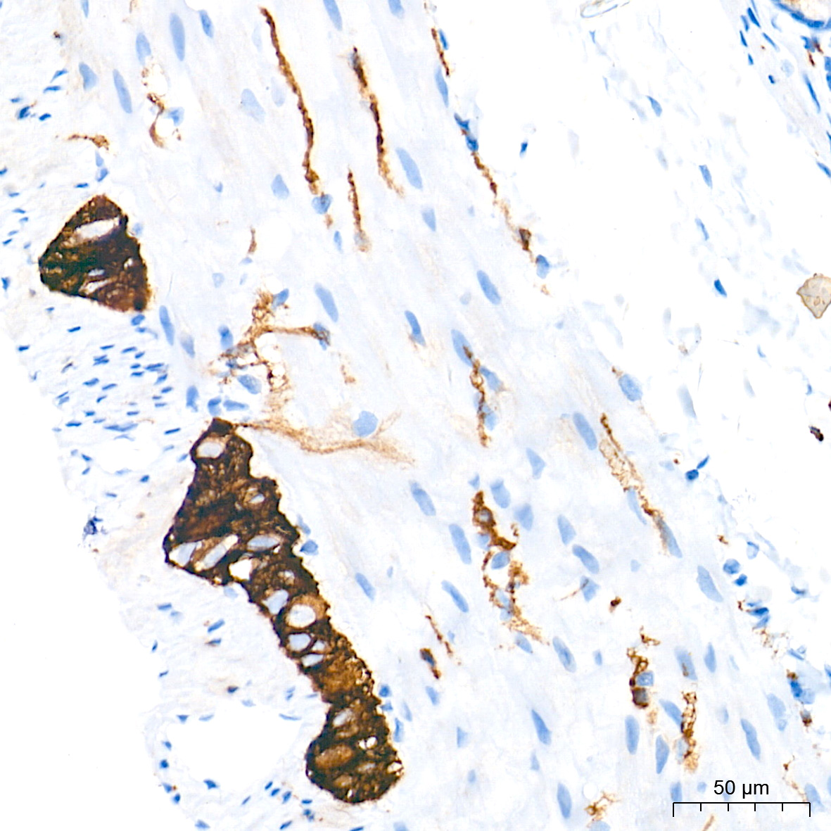 p75NTR/NGFR Rabbit PolymAb®