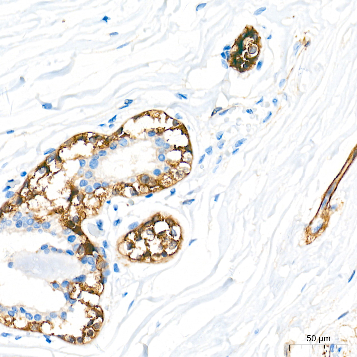 p75NTR/NGFR Rabbit PolymAb®