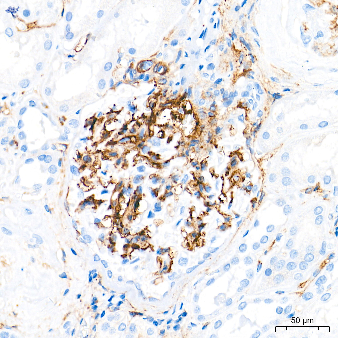 p75NTR/NGFR Rabbit PolymAb®