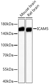 ICAM5 Rabbit mAb