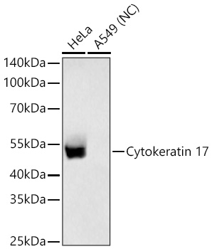 Cytokeratin 17 Rabbit mAb