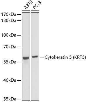 Cytokeratin 5 Rabbit mAb