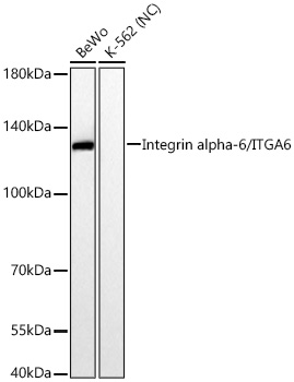 Integrin alpha-6/ITGA6 Rabbit mAb