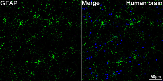 ABflo® 488 Conjugated GFAP Rabbit mAb