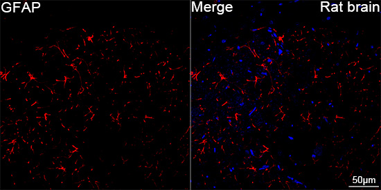 ABflo® 647 Conjugated GFAP Rabbit mAb