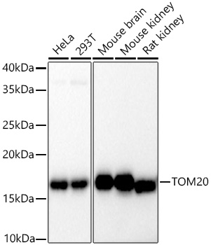 ABflo® 647 Conjugated TOM20 Rabbit mAb