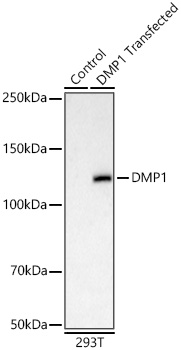 DMP1 Rabbit mAb