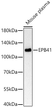 EPB41 Rabbit mAb