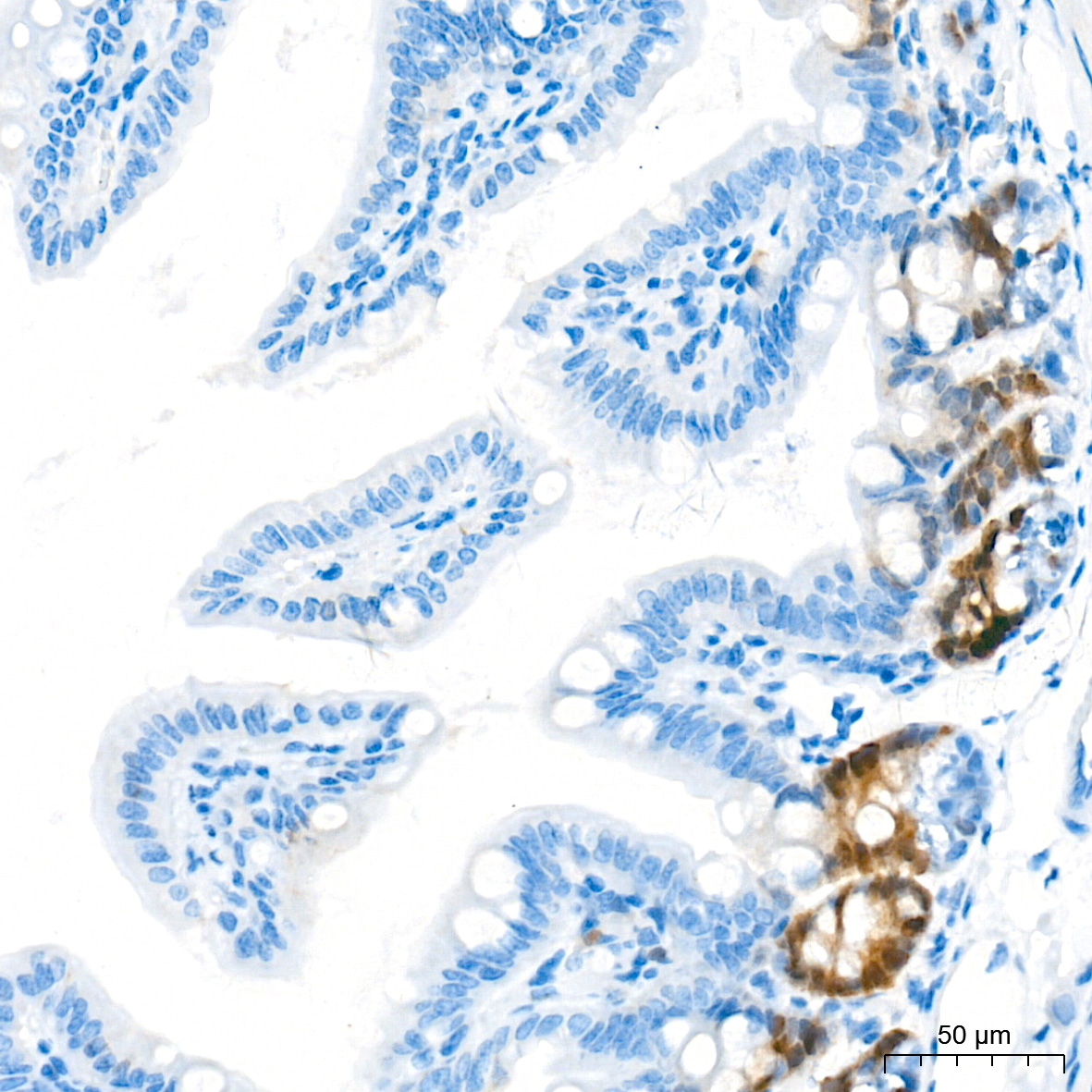RAD51 Rabbit mAb