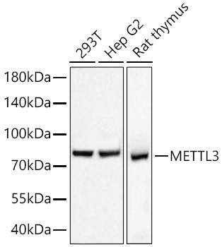 [KD Validated] METTL3 Rabbit mAb