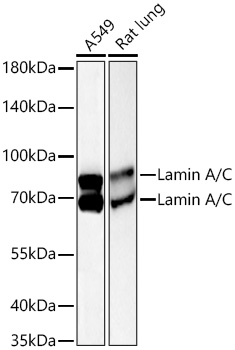 [KO Validated] Lamin A/C Mouse mAb