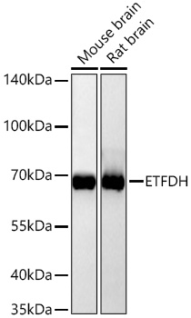 [KD Validated] ETFDH Rabbit mAb