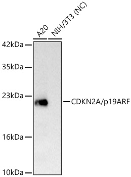 CDKN2A/p19ARF Rabbit mAb