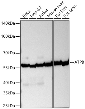 ATPB Mouse mAb