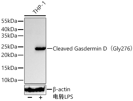 Cleaved Gasdermin D（Gly276） Rabbit mAb