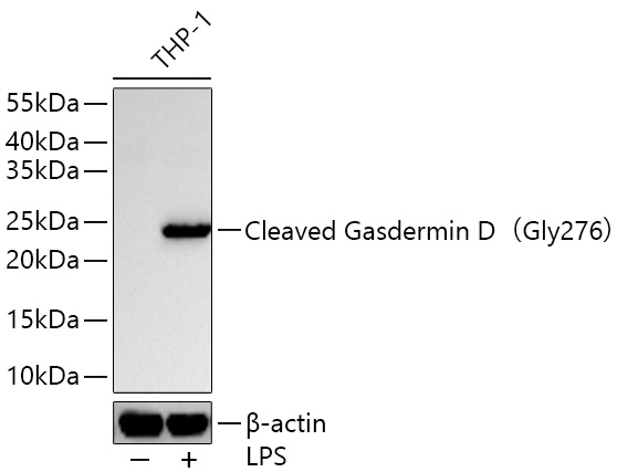 Cleaved Gasdermin D（Gly276） Rabbit mAb