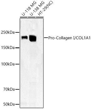 Pro-Collagen I/COL1A1 Rabbit mAb