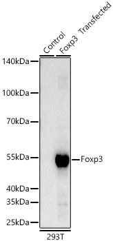 Foxp3 Rabbit mAb