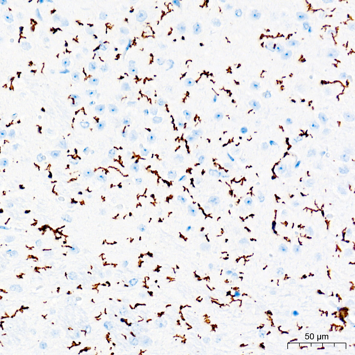 TMEM119 Rabbit mAb