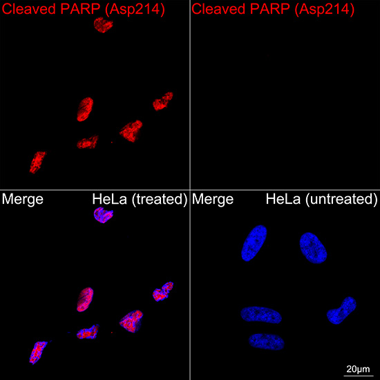 味噌　エイブ・サピエン（ラスプーチン無し） Cleaved PARP (Asp214) Rabbit mAb