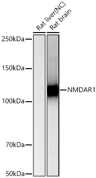 NMDAR1 Rabbit mAb