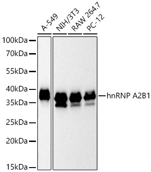 [KD Validated] hnRNP A2B1 Rabbit mAb