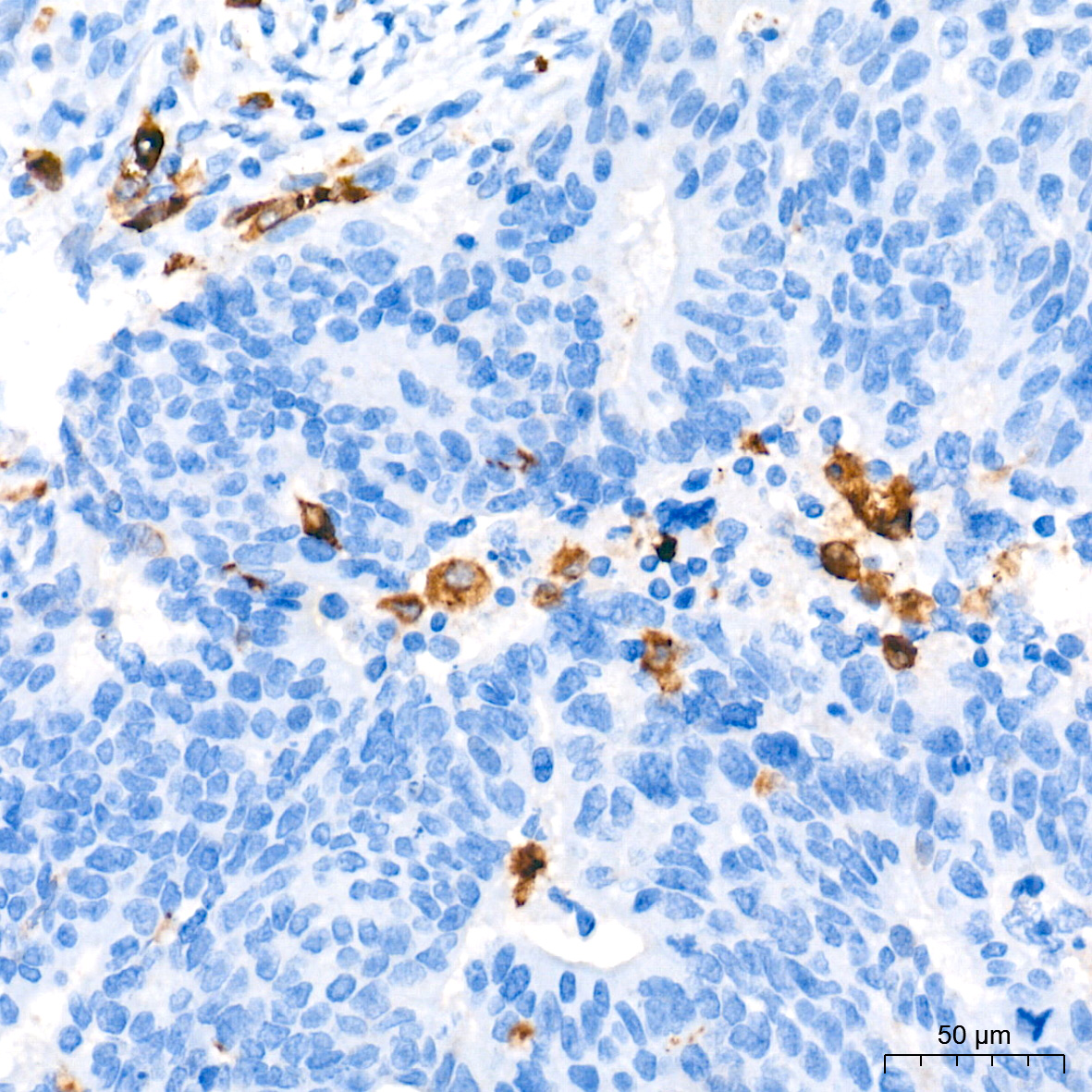 ACP5 Rabbit mAb-Monoclonal Antibodies - ABclonal/拜爾國際(BioAb)