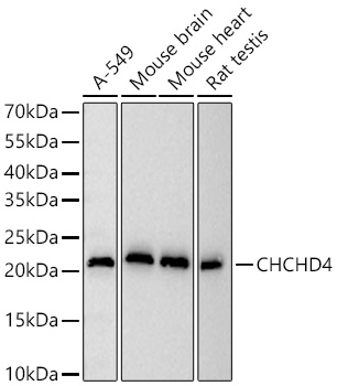 [KD Validated] CHCHD4 Rabbit mAb